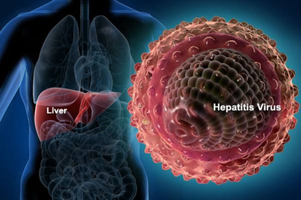 Virus Hepatitis Akut Misterius.