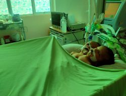 Usai Operasi, Bayi Kembar Siam Mendapat Perawatan Intensif di RSUP M Djamil Padang
