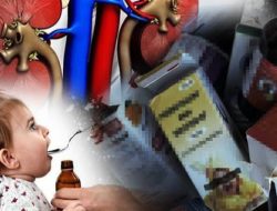 Polda Sumbar Larang Apotek Jual Obat Jenis Sirup