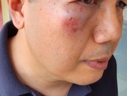 Pelaku Penganiaya Pengurus KKP Padang Ditangkap